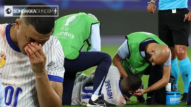Euro 2024'te heyecan dolu anlar! Fransa'nın yıldızı Kylian Mbappe'nin kanlar içindeki mücadelesi gözleri yaşarttı